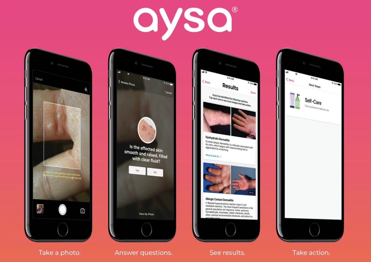 VisualDx Makes AI Skin Symptom Checker App Aysa Available ...