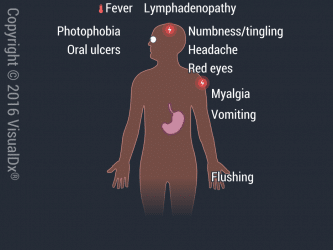 Viral Hemorrhagic Fevers | VisualDx