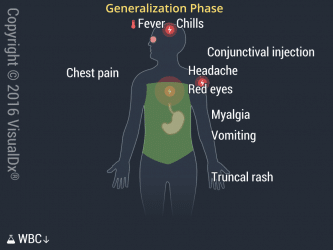 Viral Hemorrhagic Fevers | VisualDx