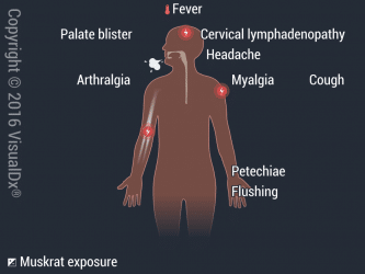 Viral Hemorrhagic Fevers | VisualDx