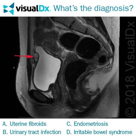 Young Woman Sees Gynecologist for 2nd Opinion on Her Abnormal Pain ...