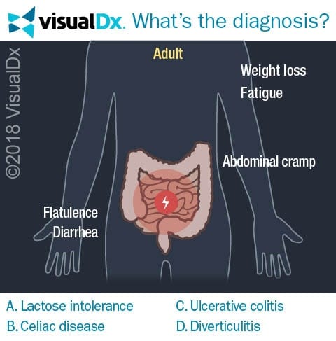 Woman with Stomach Issues Suddenly Drops Weight - Let’s Diagnose | VisualDx