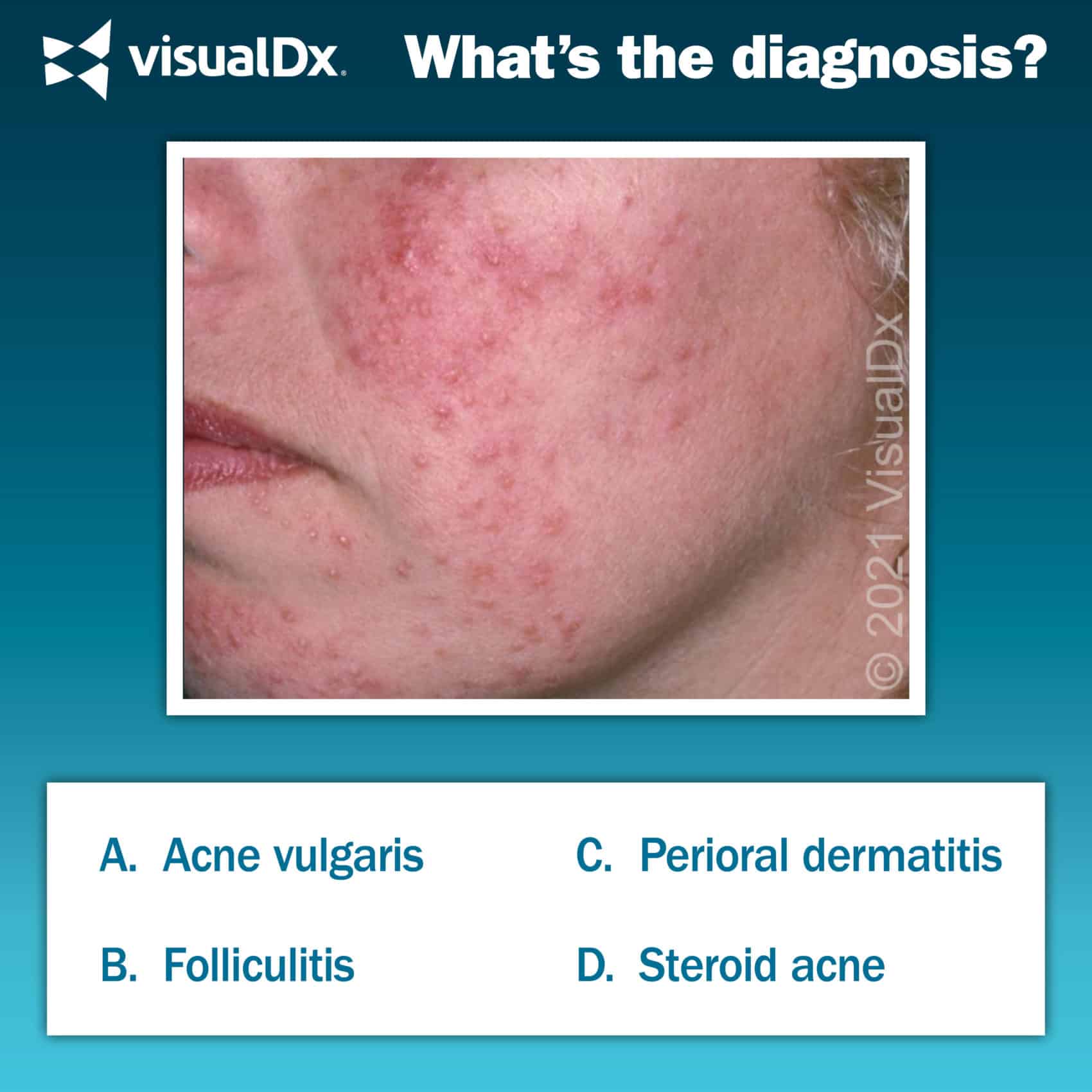 Woman’s Topical Med Leads to Facial Rash - Let’s Diagnose