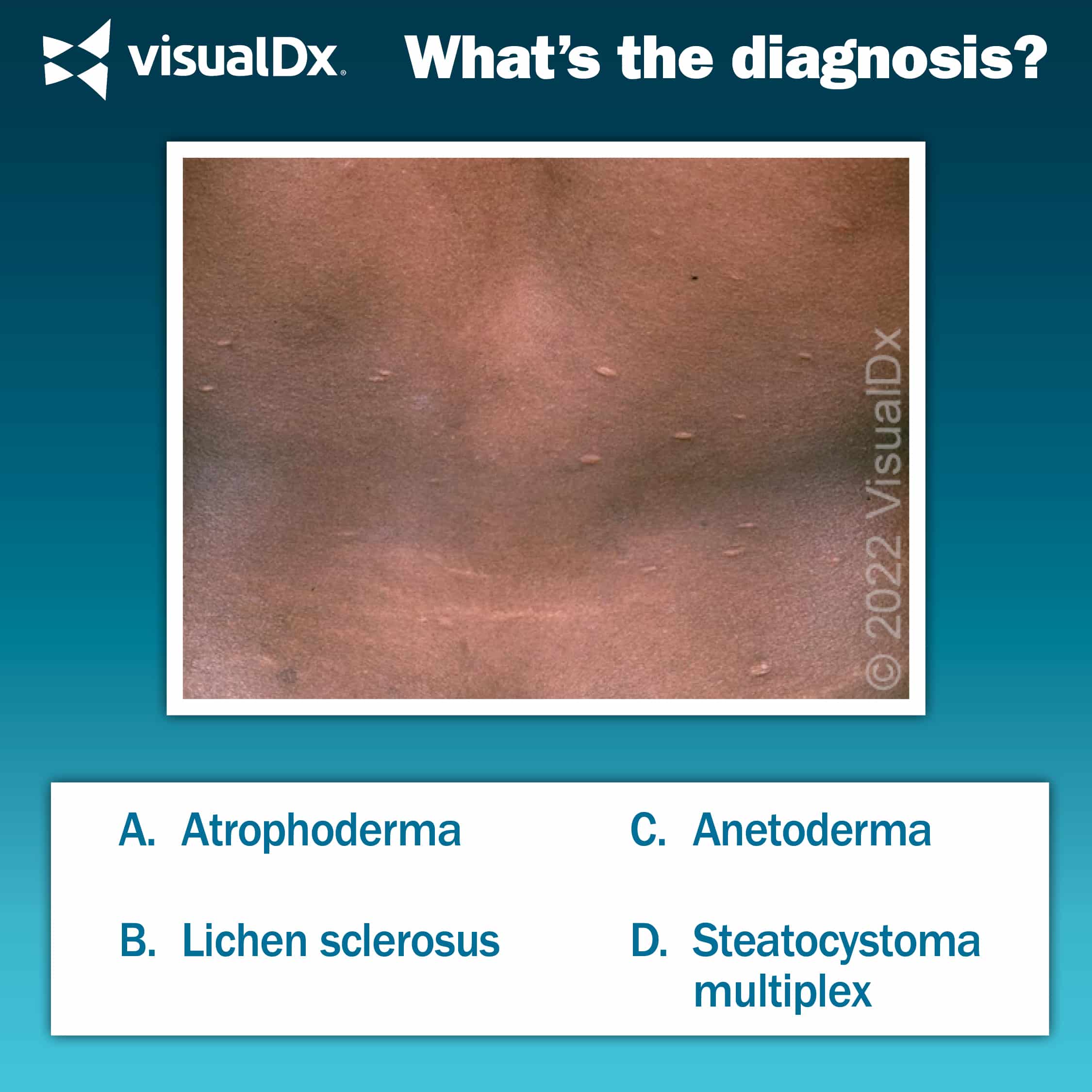 Man has skin atrophy, papules, macules - Let’s Diagnose