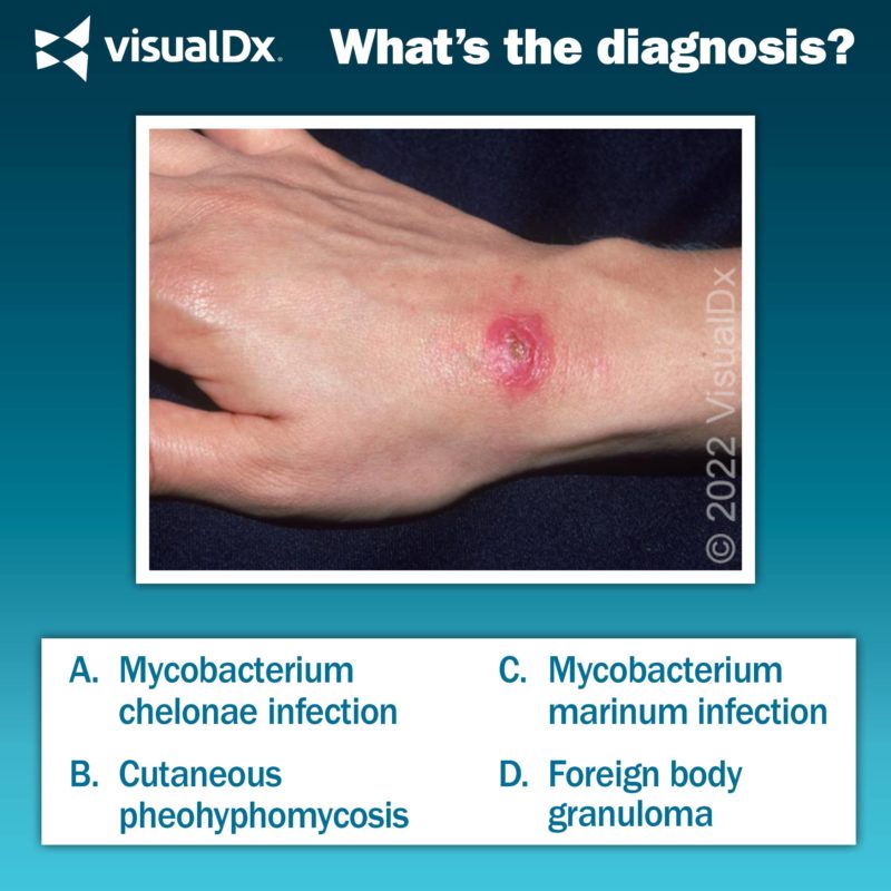 What’s fishy about this nodule? - Let’s diagnose