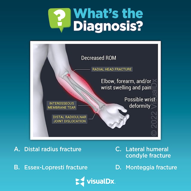 An icy fall leads to immediate arm swelling, pain. Let’s diagnose.