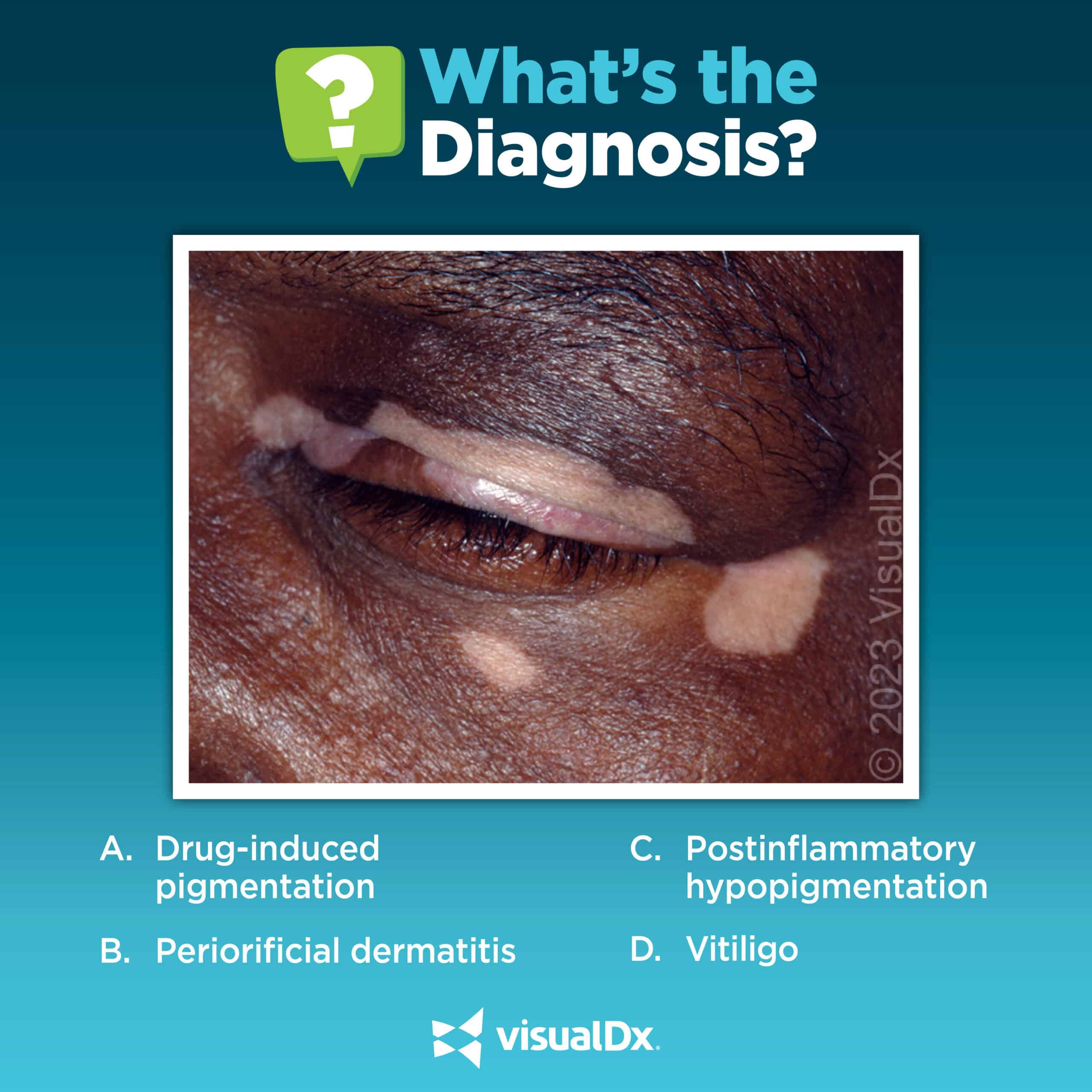 Quiz time! What's causing the discoloration around the eyes?